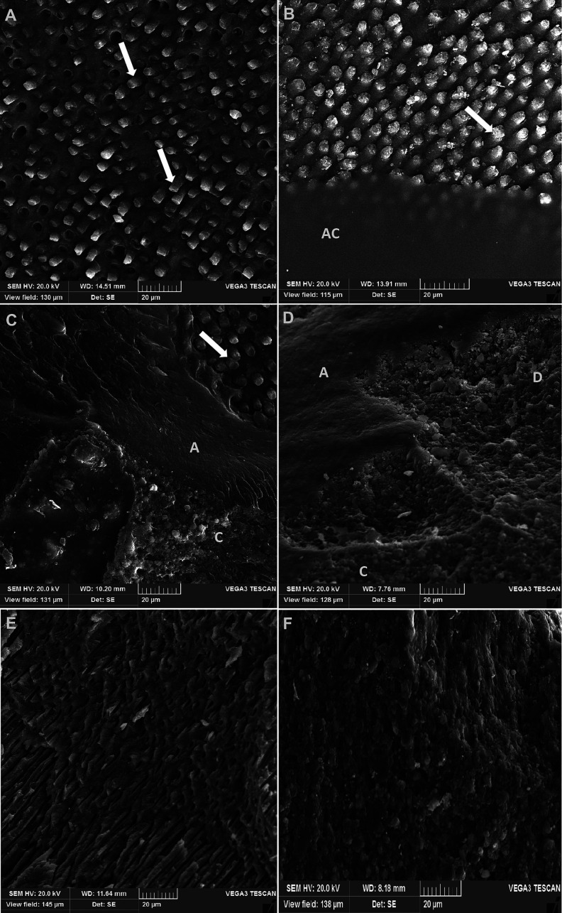 Effect of Brazilian red propolis on microtensile bond strength and sealing ability of the methacrylate-based bonding agents.