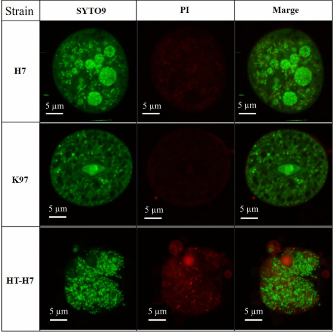 Environmentally derived Balamuthia mandrillaris contains endosymbiotic bacteria.