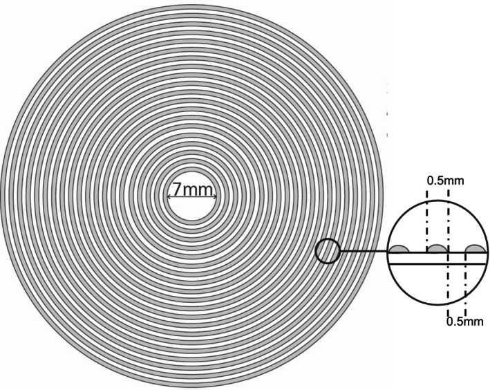 Clinical evaluation of MyoCare in Europe (CEME) for myopia management: One-year results.