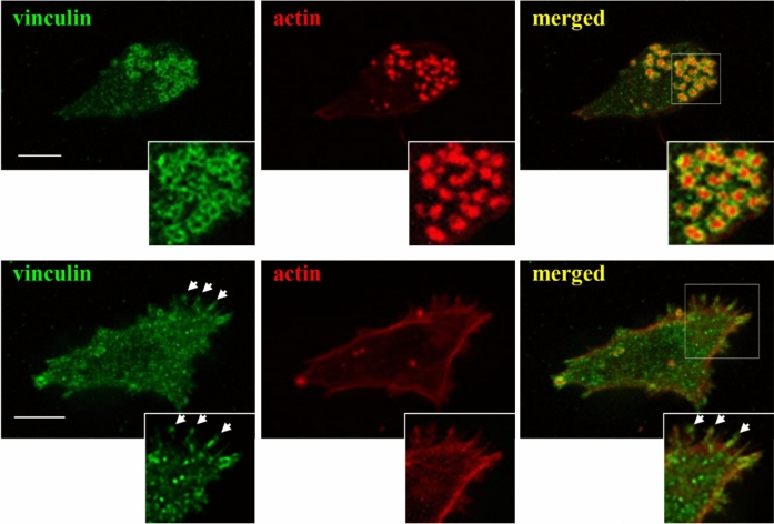 Plasticity in leukocyte migration during haematopoiesis and inflammation.