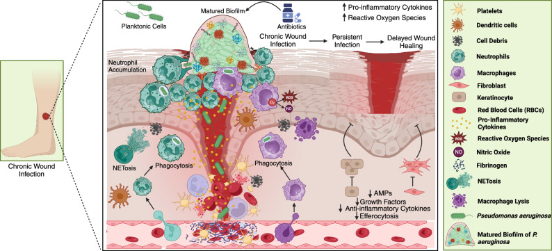 Immune system dynamics in response to Pseudomonas aeruginosa biofilms.
