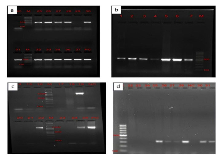 Phenotypic, genotypic characterization and antimicrobial resistance profiling of uropathogenic <i>Escherichia coli</i> in a tertiary care hospital, Puducherry, India.