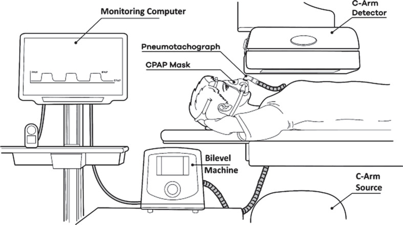 X-ray velocimetry in dynamic imaging: a systematic overview of approaches.