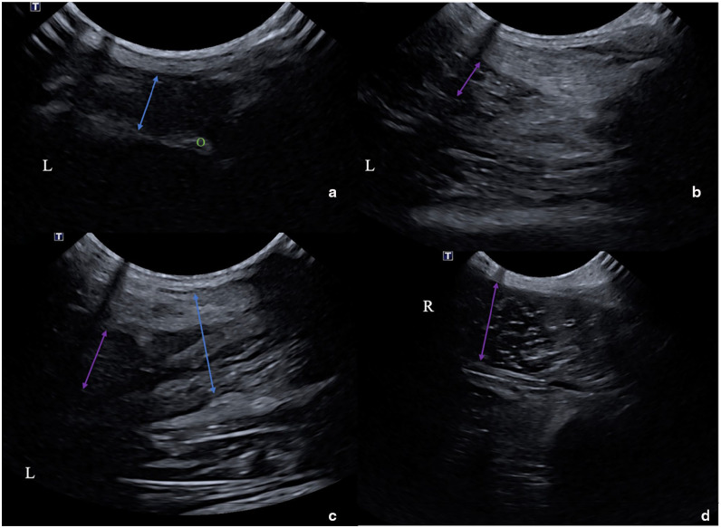 Challenging surgical management of a major triceps tendon avulsion in a 4.6 kg cat without external coaptation.