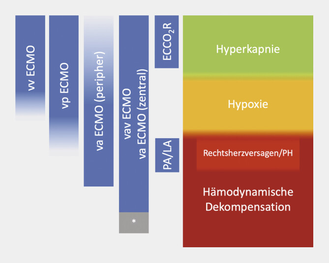 [Extracorporeal Life Support in Lung Transplantation and Beyond].