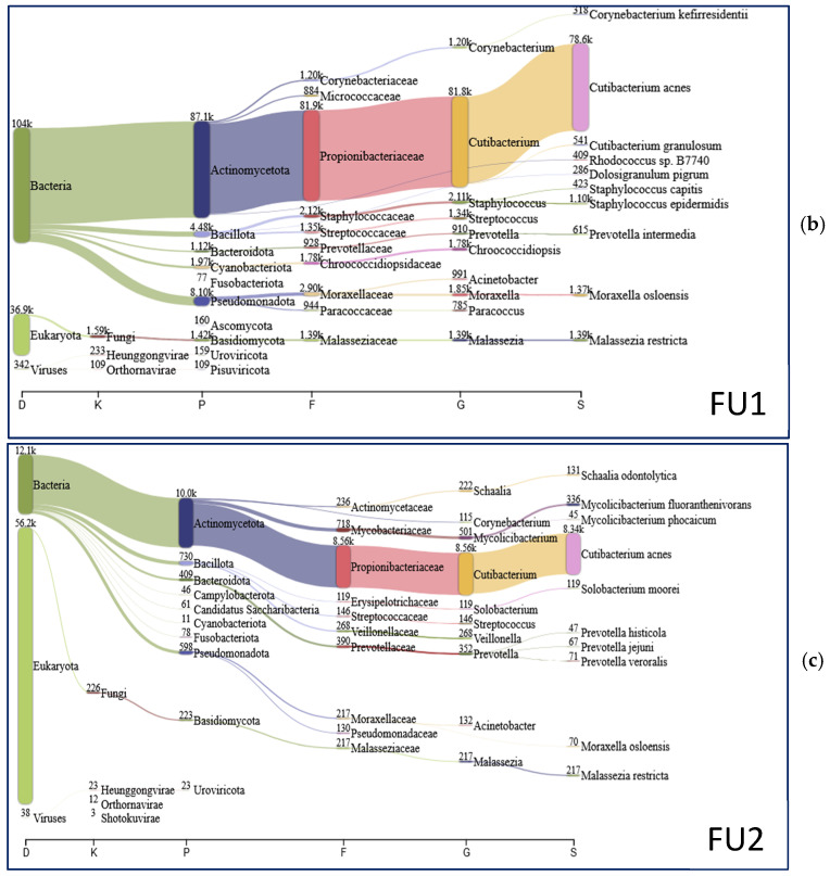 <i>Tropheryma whipplei</i> and <i>Giardia intestinalis</i> Co-Infection: Metagenomic Analysis During Infection and the Recovery Follow-Up.