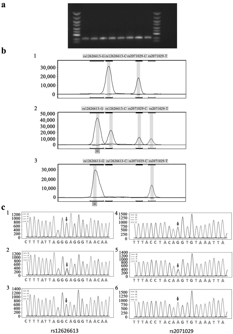 Susceptibility of RUNX1 promoter rs2071029 polymorphism to adjuvant chemotherapy-induced neutropenia in CRC.