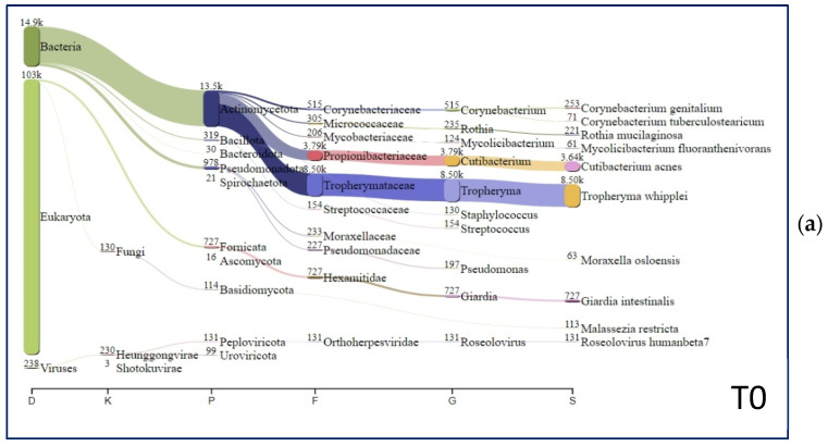 <i>Tropheryma whipplei</i> and <i>Giardia intestinalis</i> Co-Infection: Metagenomic Analysis During Infection and the Recovery Follow-Up.