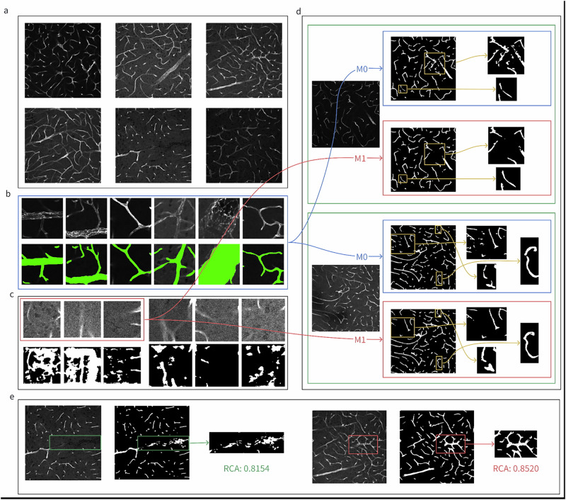 Rethinking deep learning in bioimaging through a data centric lens.