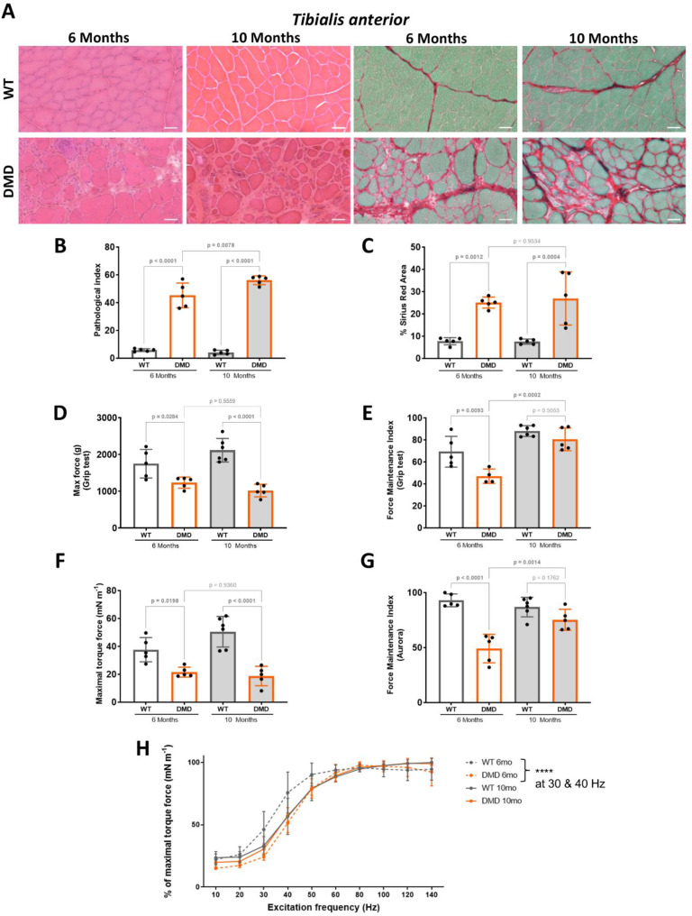 Extensive striated muscle damage in a rat model of Duchenne muscular dystrophy with Dmd exons 10-17 duplication.
