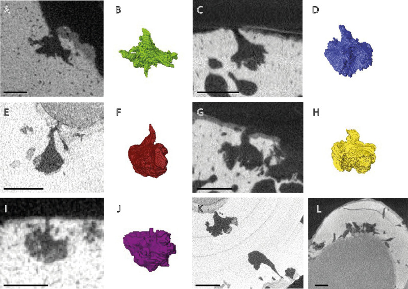 Correction: The evolution of bone-eating worm diversity in the Upper Cretaceous Chalk Group of the United Kingdom.