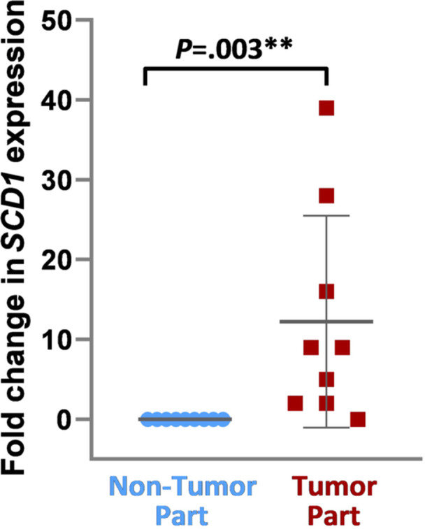 Targeting Stearoyl-CoA Desaturase 1 Through PI3K-AKT-mTOR Signaling in Head and Neck Squamous Cell Carcinoma.