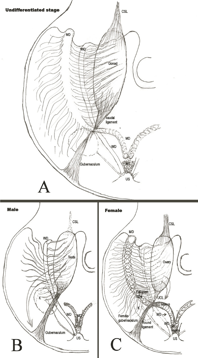 Euro-Chinese consensus on accessory cavitated uterine malformation<sup>*,†</sup>.