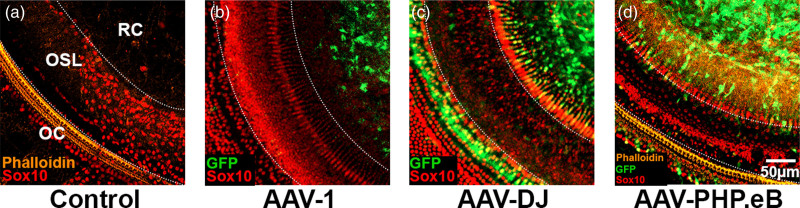 AAV-mediated transgene delivery targeting spiral ganglion nonsensory cells.