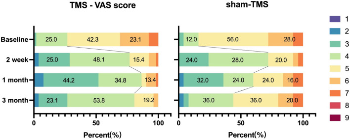 Efficacy and Safety Analysis of Repetitive Transcranial Magnetic Stimulation in Patients with Persistent Postural Perceptual Dizziness: A Single-Center, Single-Blind, Randomized Placebo-Controlled Trial.