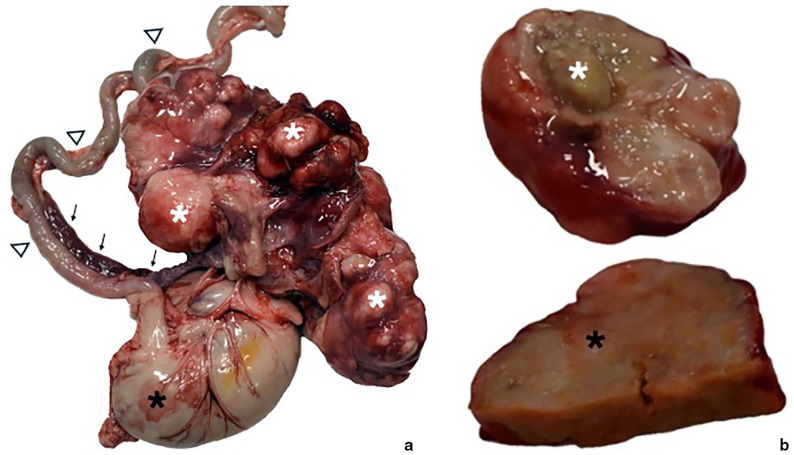 Bicavitary involvement of feline eosinophilic sclerosing fibroplasia with intralesional methicillin-resistant <i>Staphylococcus aureus</i>.