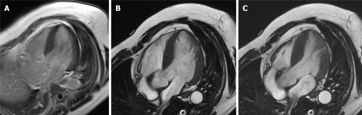 Diagnostic usefulness and limitation of cardiac magnetic resonance for identifying myocardial damage in survivors of cardiac arrest in midtown.