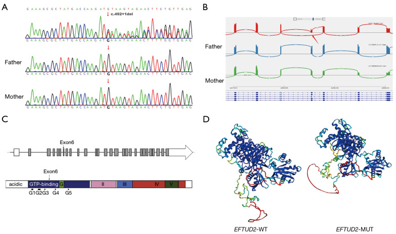 A novel <i>EFTUD2</i> splicing variant causing mandibulofacial dysostosis with microcephaly: a case report.