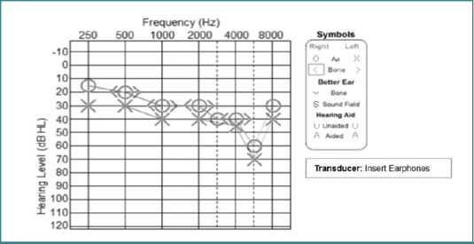 Noise-induced hearing loss among military personnel in Saudi Arabia: a preliminary study.