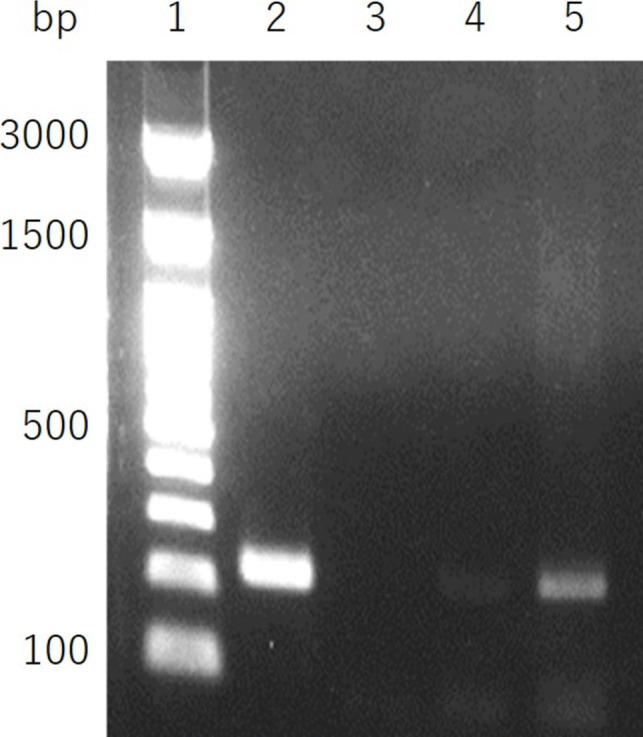 Environmentally derived Balamuthia mandrillaris contains endosymbiotic bacteria.