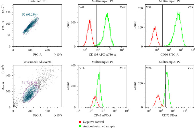 Immunoregulation of Quercetin and Kynurenic Acid on Human Umbilical Cord Mesenchymal Stem Cells Through Gene Expression of Aryl Hydrocarbon Receptor and Interleukin-6 in Hyperglycemic Milieu.