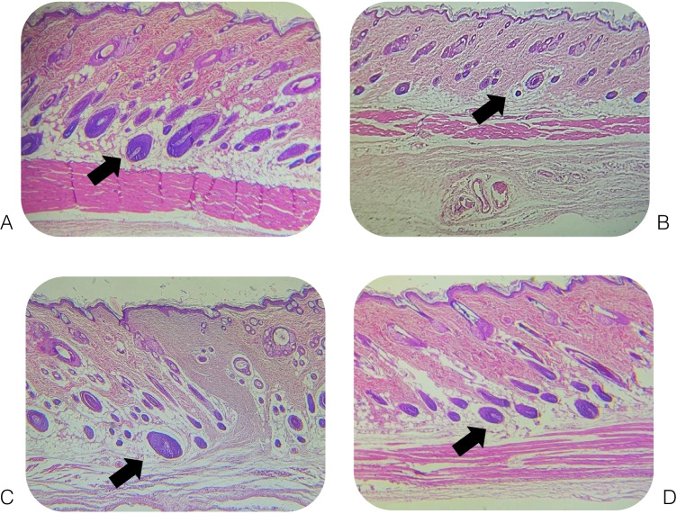 Cytotoxicity and subcutaneous tissue response of beta RCS in comparison with ADSeal and AH plus endodontic sealers: in vitro/in vivo study.