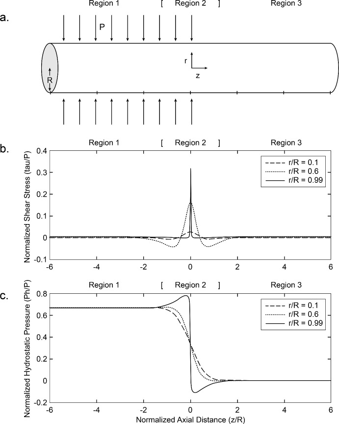 The Pathogenesis of Papilledema: Review of the Literature and a New Hypothesis.