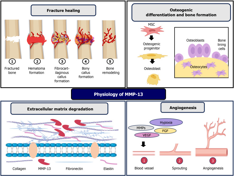 Regulation of matrix metalloproteinase-13 in cancer: Signaling pathways and non-coding RNAs in tumor progression and therapeutic targeting.