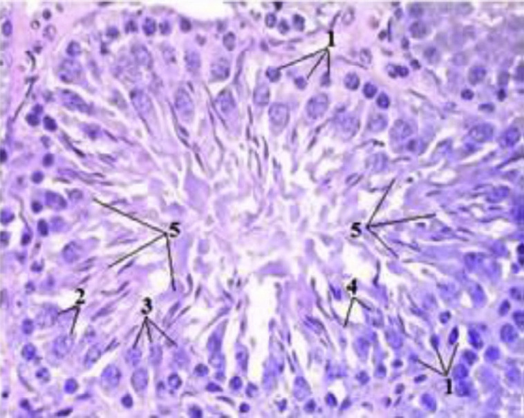Pathological and vascular changes in the rat testiсle after experimental trauma.