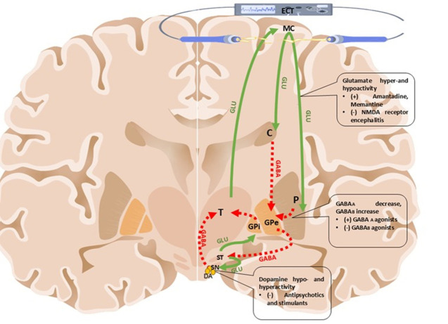 Does Dysregulation Of The Indirect Pathway Contribute To The Pathophysiology Of Catatonia Through Neurotransmitter Imbalance?