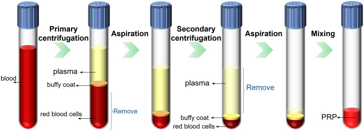 Efficient quality control of platelet-rich plasma preparation using computer vision and deep learning.