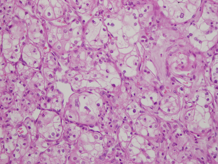 Long live the kidney despite every threats: a case report.