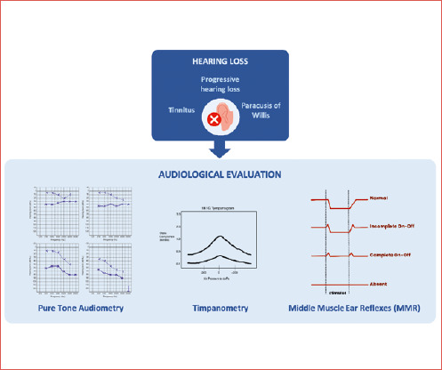 Issues in the audiological assessment of otosclerosis.