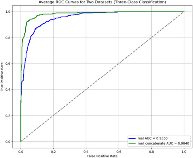 Research on automatic assessment of the severity of unilateral vocal cord paralysis based on Mel-spectrogram and convolutional neural networks.