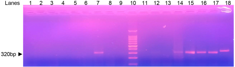 Can archived lesion smears be used to identify Leishmania species in regions with high species diversity?