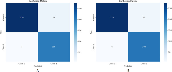 Research on automatic assessment of the severity of unilateral vocal cord paralysis based on Mel-spectrogram and convolutional neural networks.