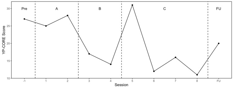 Cognitive Analytic Therapy for Functional/Dissociative Seizures in an Adolescent: Case Report and Mixed-Methods Single-Case Evaluation.