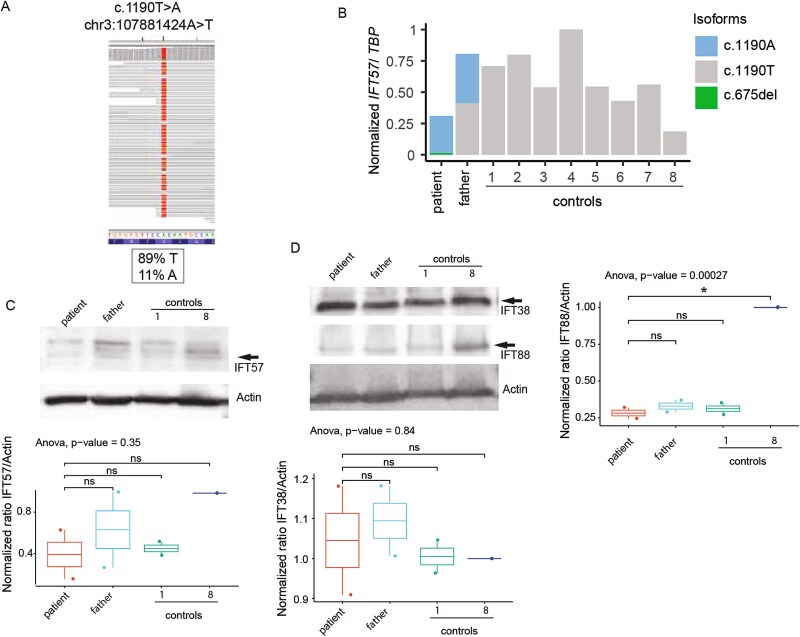 Defective IFT57 underlies a novel cause of Bardet-Biedl syndrome.