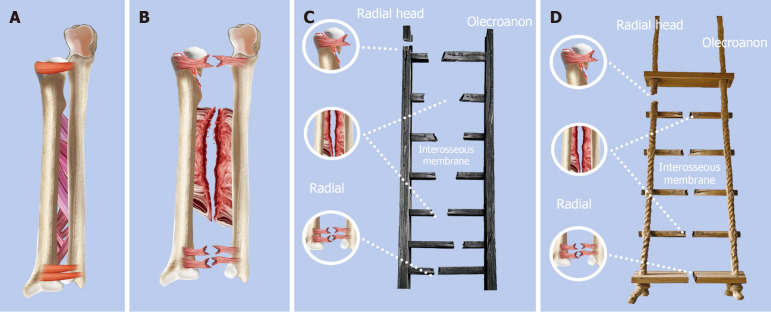 Progress in diagnosis and treatment of Essex-Lopresti injury in children.