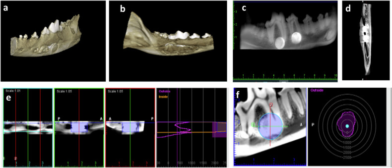 Osteogenic potential of nanostructured Cu/W/Co in Fe-Mn alloys designed for maxillofacial applications: in vivo study in dog model.