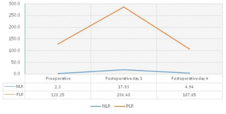 Effect of Systemic Immune-Inflammation Index on Prognosis in Non-Functional Mitral Regurgitation Patients Undergoing Isolated Mitral Valve Replacement.