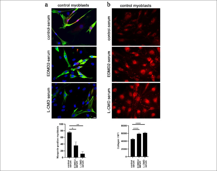 Anti-myogenic and profibrotic effect of serum from patients affected by muscular laminopathies.