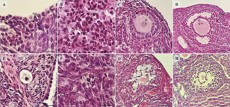 Protective effects of Aloe vera extract against doxorubicin-induced degeneration in ovarian follicles and stromal cells in mice.