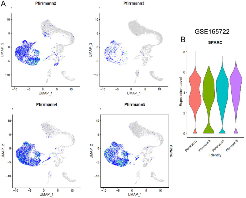 Molecular Mechanisms of Intervertebral Disc Degeneration: Significance of SPARC Gene Expression.