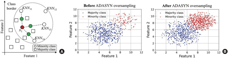Synthetic Data-Enhanced Classification of Prevalent Osteoporotic Fractures Using Dual-Energy X-Ray Absorptiometry-Based Geometric and Material Parameters.