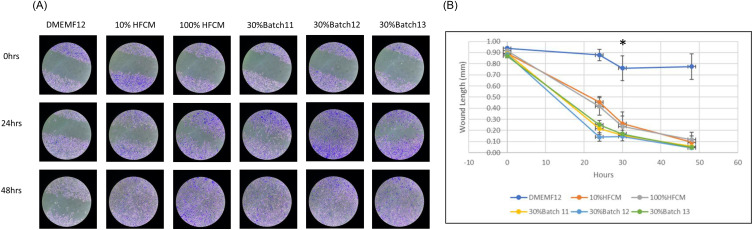Novel, Reproducible, Consortia Factors Derived from Adipose Stem Cells for Burn Wound Treatment.