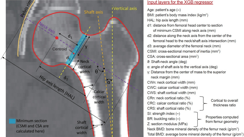 Synthetic Data-Enhanced Classification of Prevalent Osteoporotic Fractures Using Dual-Energy X-Ray Absorptiometry-Based Geometric and Material Parameters.