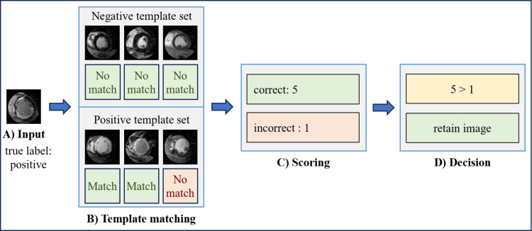 Investigating methods to enhance interpretability and performance in cardiac MRI for myocardial scarring diagnosis using convolutional neural network classification and One Match.