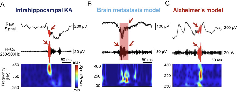 How Can Animal Models Advance Research into High Frequency Oscillations: Guidelines for Recording, Detection and Analysis.