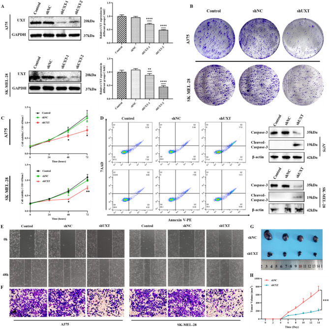UXT enhances melanoma proliferation, migration, and invasion through modulation of the P53 signaling pathway.